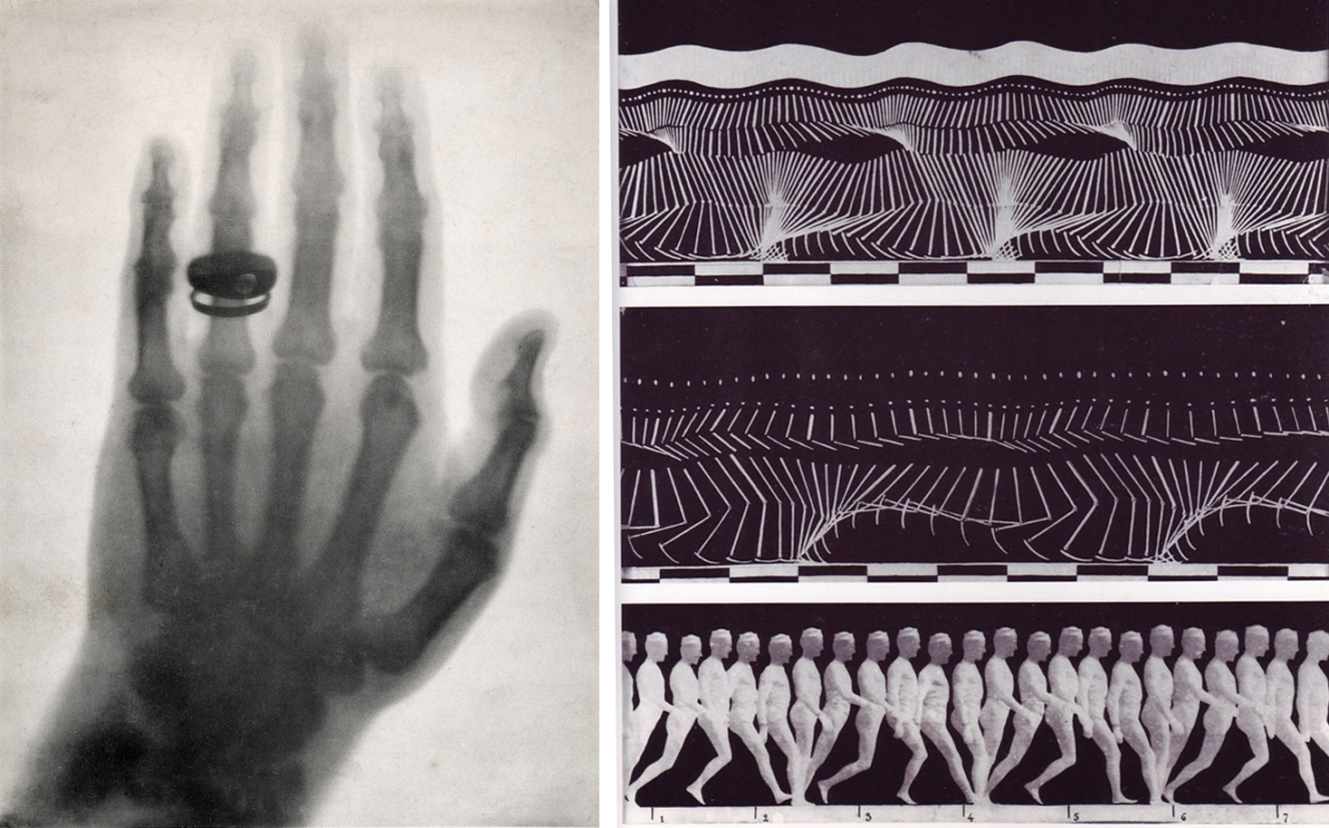 A split photograph showing an X-ray of a hand with a ring on the middle finger on the left, and a series of sequential motion study images of a walking figure on the right. The right section features three horizontal rows of white, stylized human figures and motion lines against a dark background, illustrating phases of movement and mechanical motion patterns.