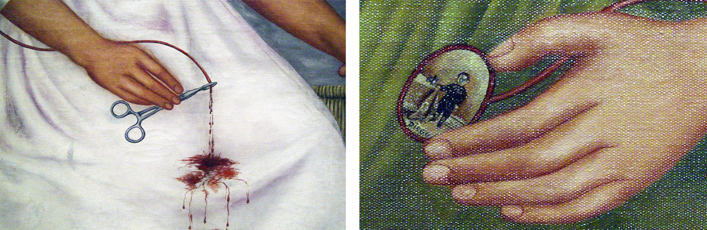 Side by side detail images from a painting showing two close-up views of hands performing medical-related actions. The left panel depicts a hand holding surgical forceps pinching a bleeding wound on white fabric, while the right panel shows a hand holding a circular miniature portrait reflecting a small figure.